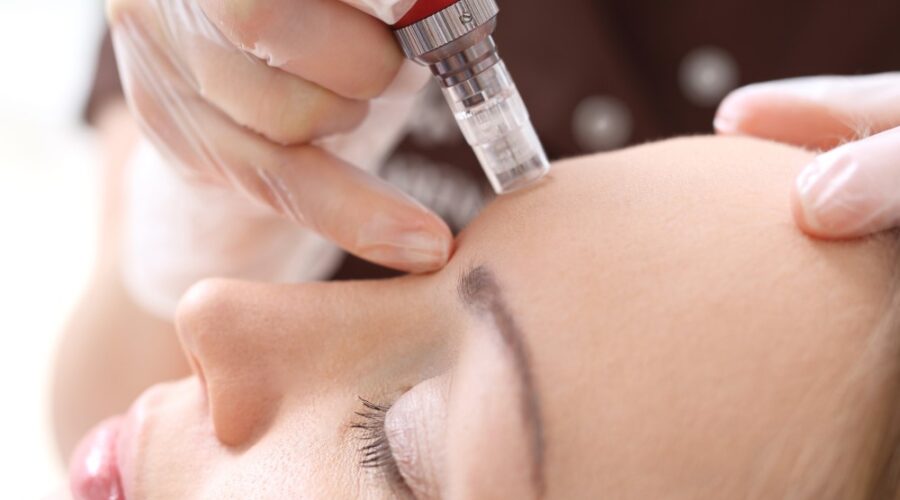 dermapen dermapen